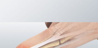 Mallet Finger (Çekiç Parmak) Yaralanması