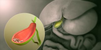 Safra Kesesi ve Safra Yolu Hastalıkları Genel Bakış