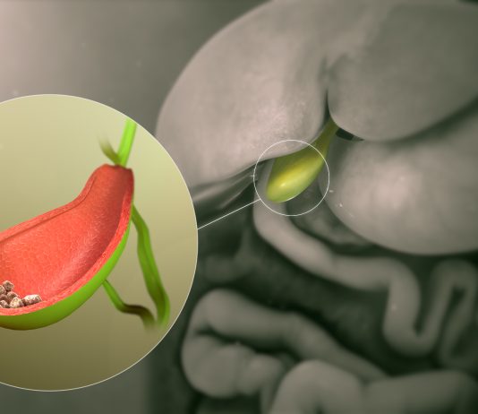 Safra Kesesi ve Safra Yolu Hastalıkları Genel Bakış