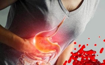 Gastrointestinal Sistem Kanamaları Genel Bakış