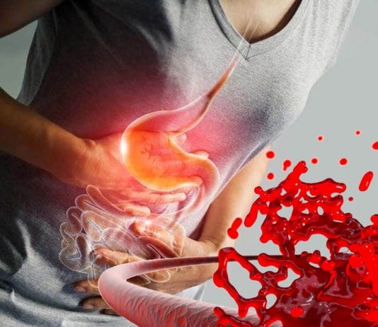 Gastrointestinal Sistem Kanamaları Genel Bakış