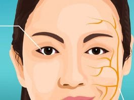 Periferik Fasiyal Paralizi