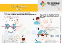 Dix-Halpike Testi (Vertigo Değerlendirmesi)