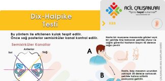 Dix-Halpike Testi (Vertigo Değerlendirmesi)