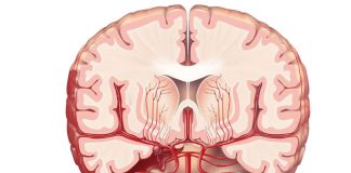 Subaraknoid Kanamaya (SAK) Acil Yaklaşım