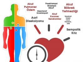 Hipertansif Acillere Yaklaşım