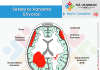 Hemorajik İnme (Stroke) Acil Yaklaşım