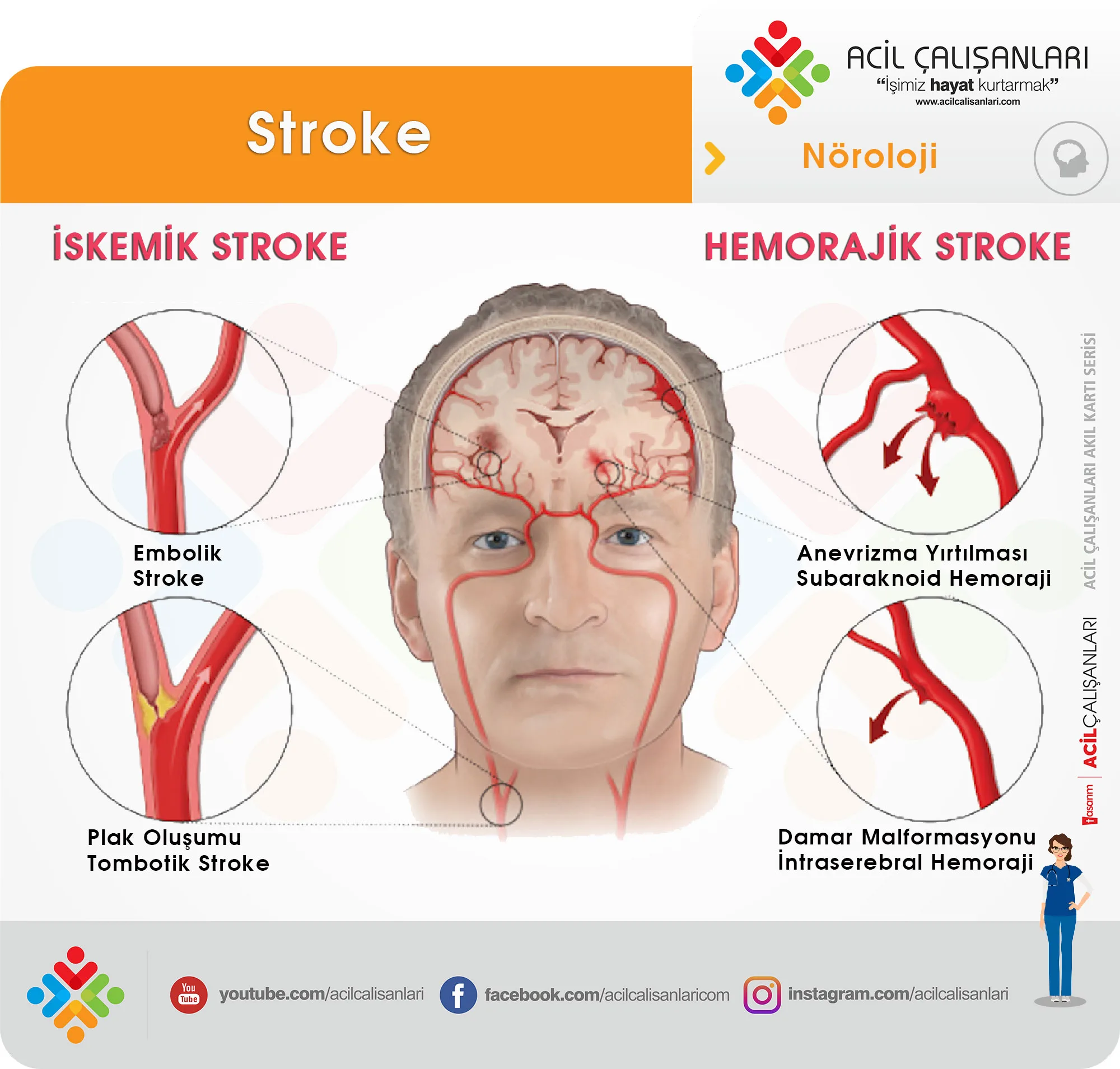 İskemik ve Hemorajik İnme