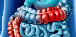 İleus Genel Yaklaşım