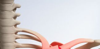 Klavikula Kırığı