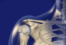 Proksimal Humerus Kırıkları