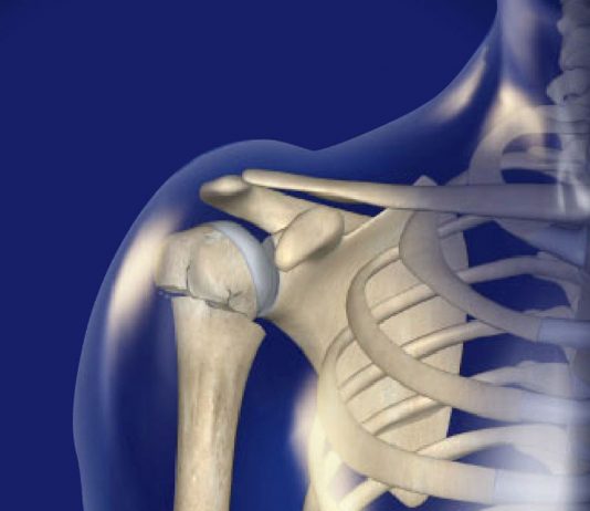 Proksimal Humerus Kırıkları