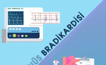 Sinüs Bradikardisi