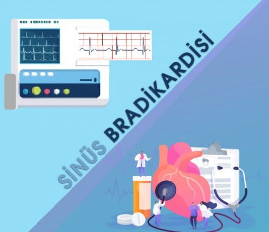 Sinüs Bradikardisi