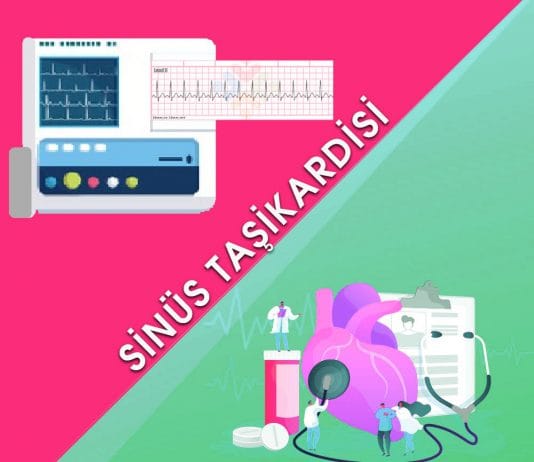 Sinüs Taşikardisi