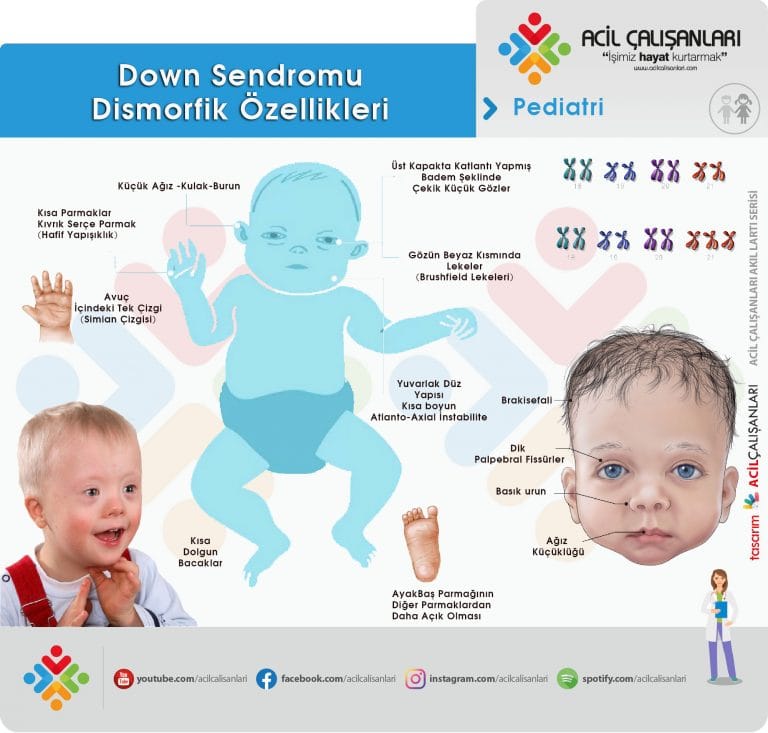 Down Sendromu Acil Çalışanları