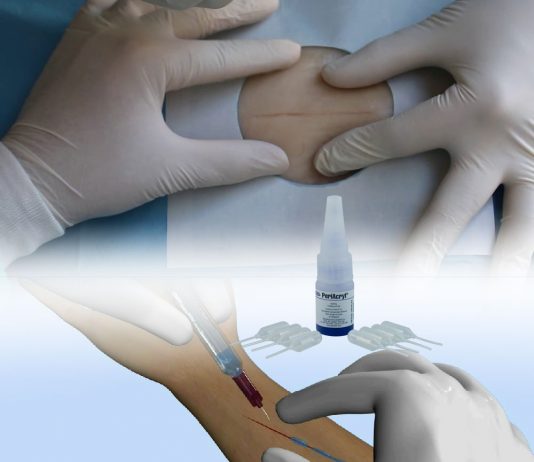 Doku Yapıştırıcısı Kullanılması