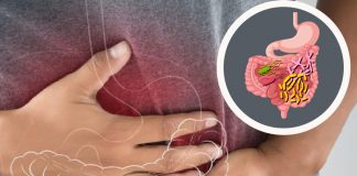 Gastroenterit ve İshal Yaklaşımı