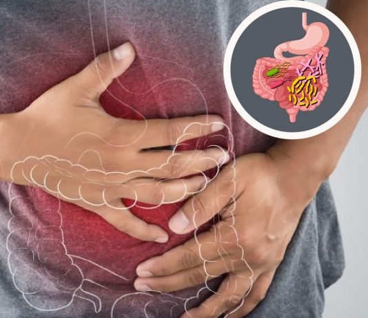 Gastroenterit ve İshal Yaklaşımı