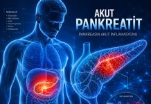 Akut Pankreatit ve Yönetimi