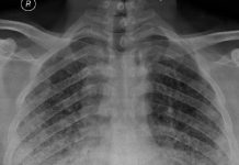 Buzlu Cam Gönünümü