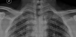 Buzlu Cam Gönünümü