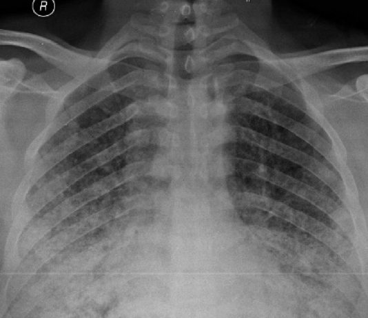 Buzlu Cam Gönünümü