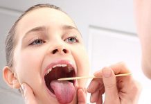 Akut Tonsillofarenjit