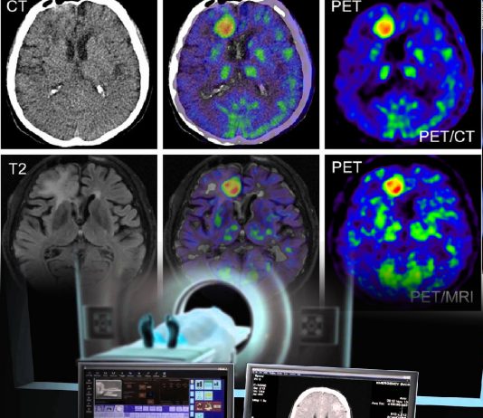 Acil Serviste Nöroradyolojik Görüntüleme