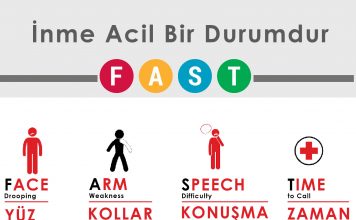 FAST İskemik İnme Erken Tanıma Akıl Kartı