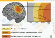İskemik Stroke Penumbra Akıl Kartı