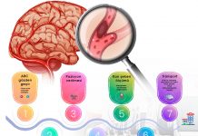 Hastane Öncesi Dönemde İnme (Stroke ) Hastasına Acil Yaklaşım