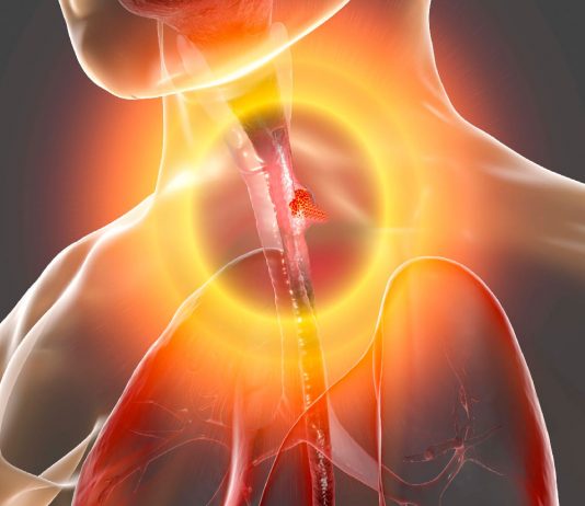 Özofagus Perforasyonu (Rüptürü)