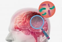 Akut Menenjit Hastasına Acil Servis Yaklaşımı