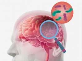 Akut Menenjit Hastasına Acil Servis Yaklaşımı