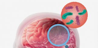 Akut Menenjit Hastasına Acil Servis Yaklaşımı