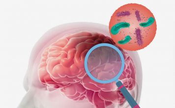 Akut Menenjit Hastasına Acil Servis Yaklaşımı