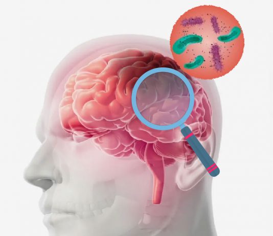 Akut Menenjit Hastasına Acil Servis Yaklaşımı