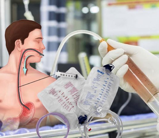 Gastrik Lavaj Uygulaması