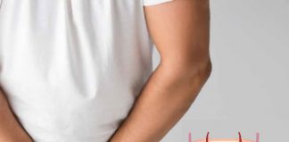 Orşit Acil Yaklaşım