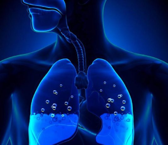 Akciğer Ödemi Tedavisi ve Acil servis Yaklaşımı