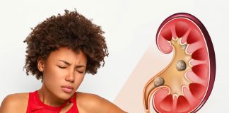 Renal Kolik ve Üriner Sistem Taşları Acil Yaklaşım