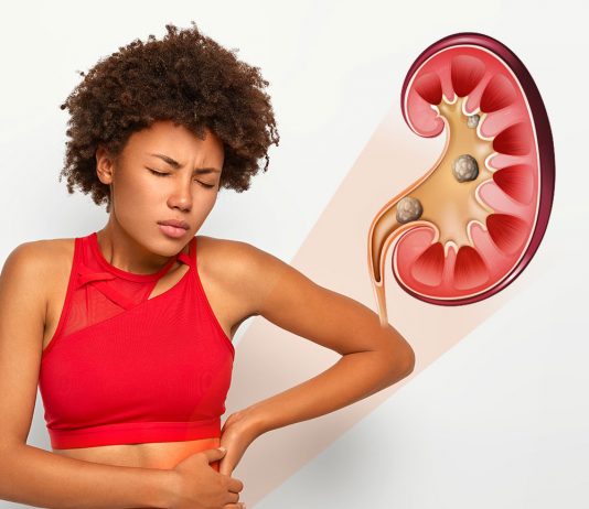 Renal Kolik ve Üriner Sistem Taşları Acil Yaklaşım