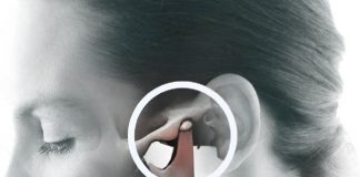 Çene Çıkığı ve Redüksiyonu