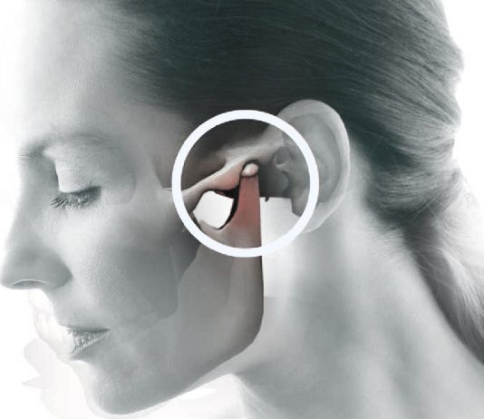 Çene Çıkığı ve Redüksiyonu