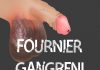 Fournier Gangreni