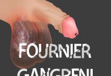 Fournier Gangreni