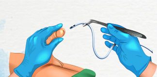 Üriner Sonda (Kateter) Takılması ve Çıkarılması