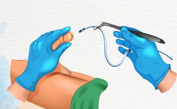 Üriner Sonda (Kateter) Takılması ve Çıkarılması