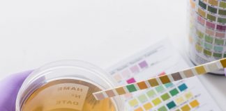 Tam İdrar Tetkiki (TİT) Değerlendirilmesi